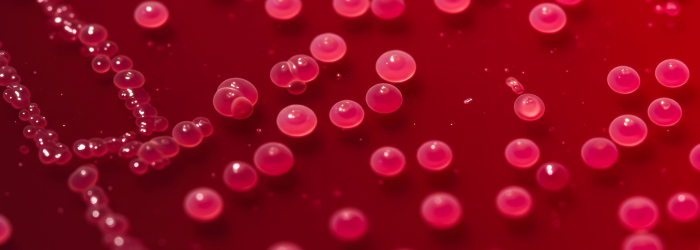 Petri Dish with Bacteria Growth