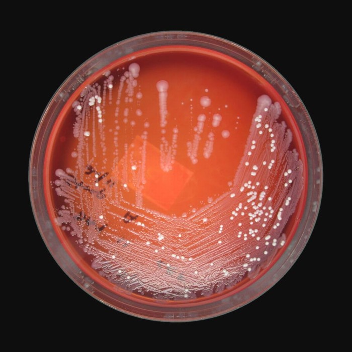Microbes in National Geographic