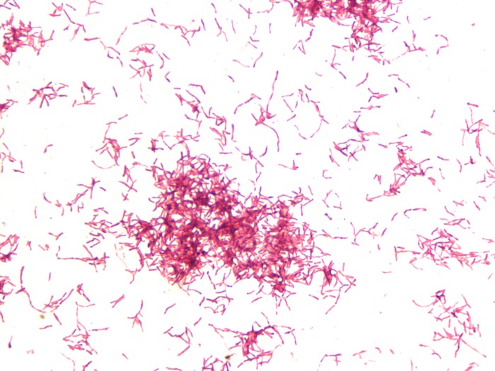 Actinomyces israelii