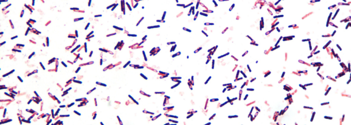 Clostridioides difficile: targeting virulence factors