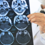 Doctor holding up brain scan