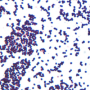 Peptostreptococcus anaerobius gram stain